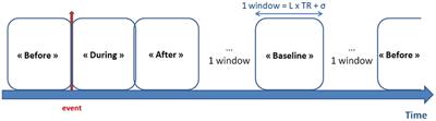 Study on the Relationships between Intrinsic Functional Connectivity of the Default Mode Network and Transient Epileptic Activity